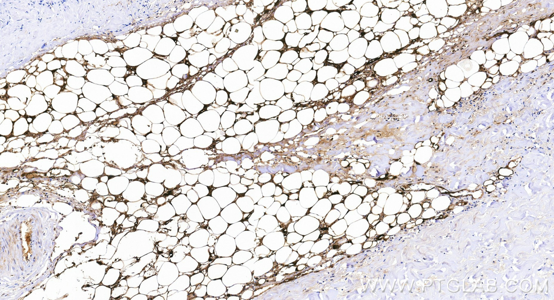 IHC staining of human skin using 85864-2-RR