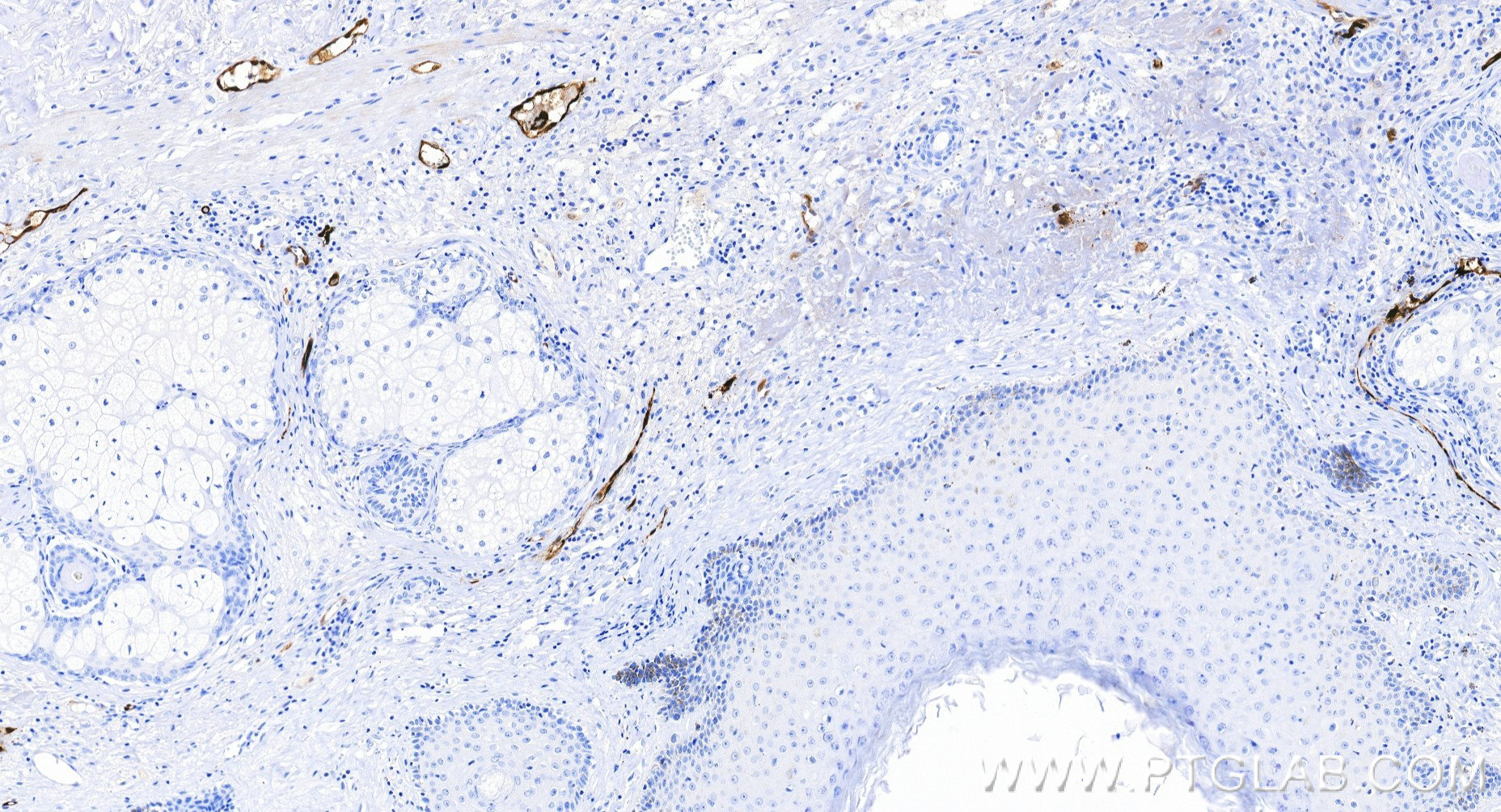 IHC staining of human skin using 85864-2-RR