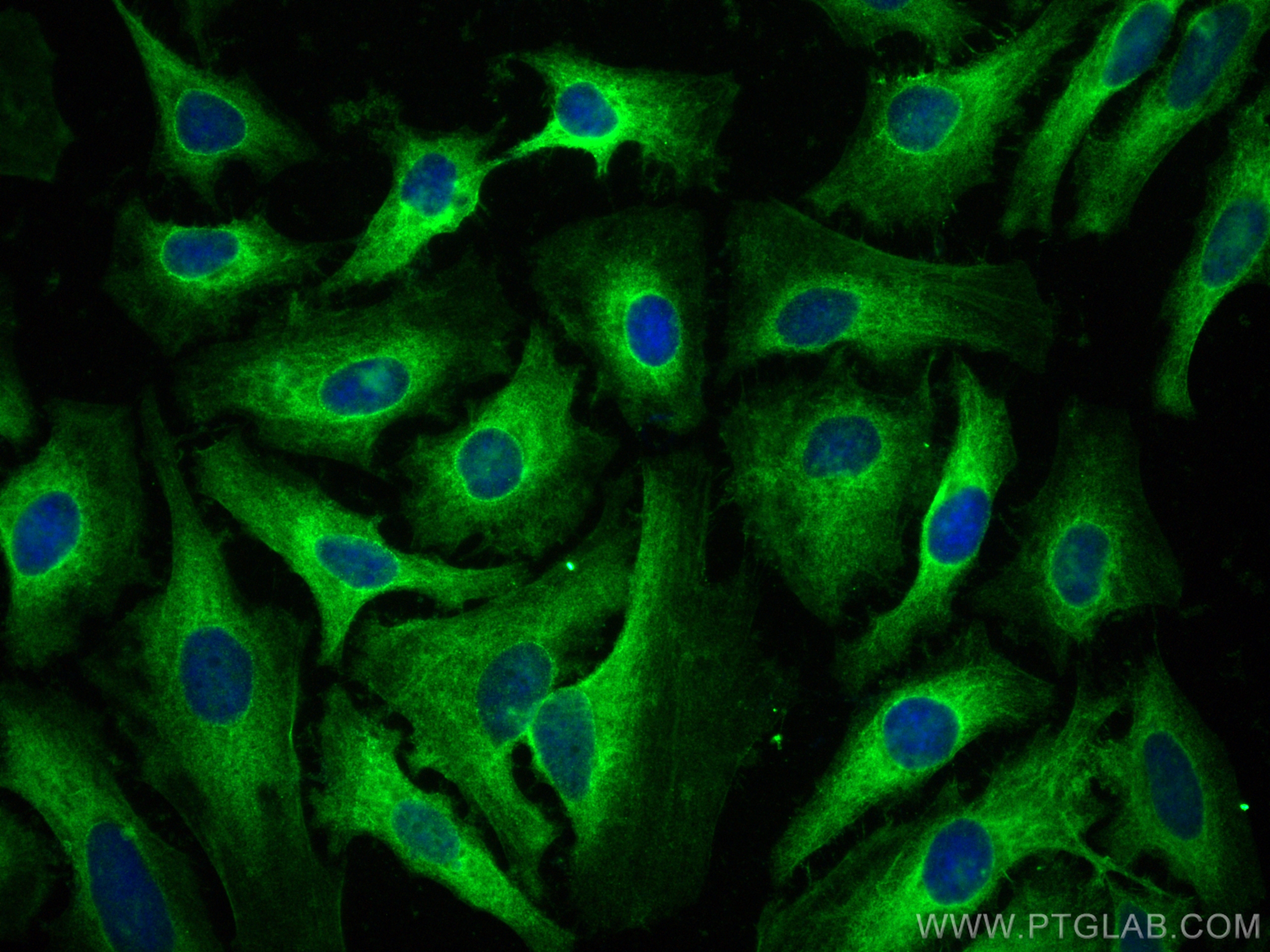 IF Staining of HeLa using 12348-1-AP