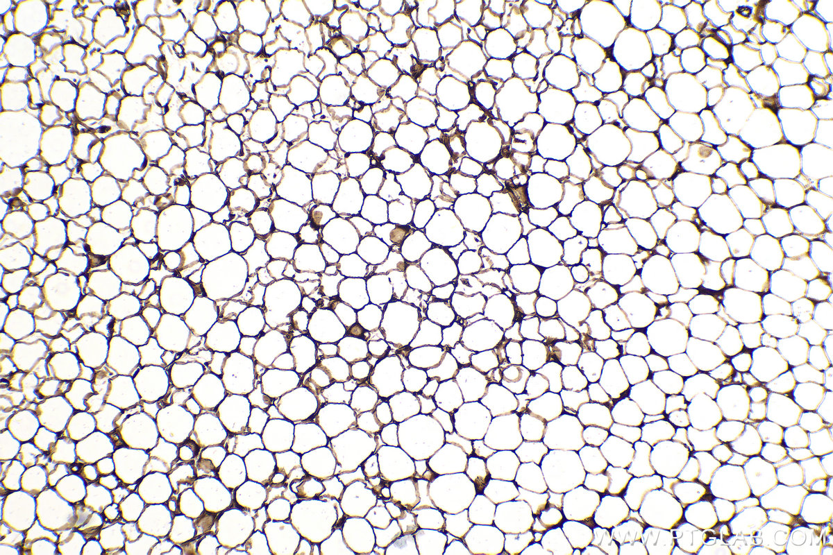 IHC staining of mouse brown adipose using 66299-1-Ig