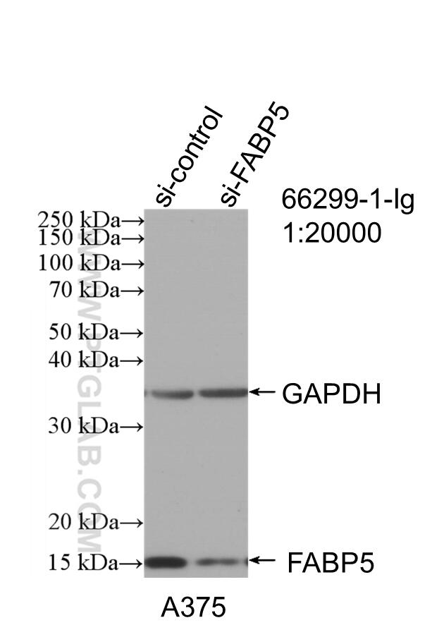 WB analysis of A375 using 66299-1-Ig