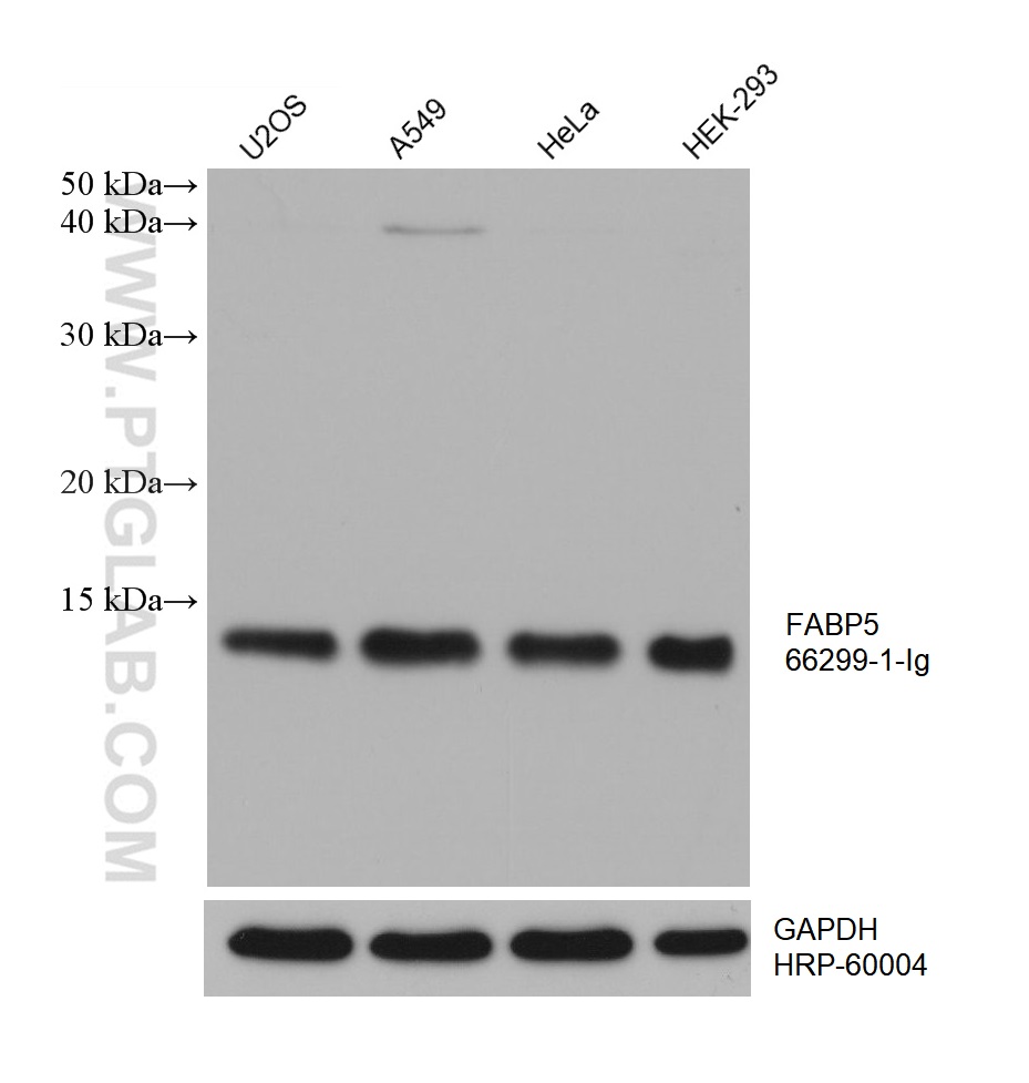 WB analysis using 66299-1-Ig