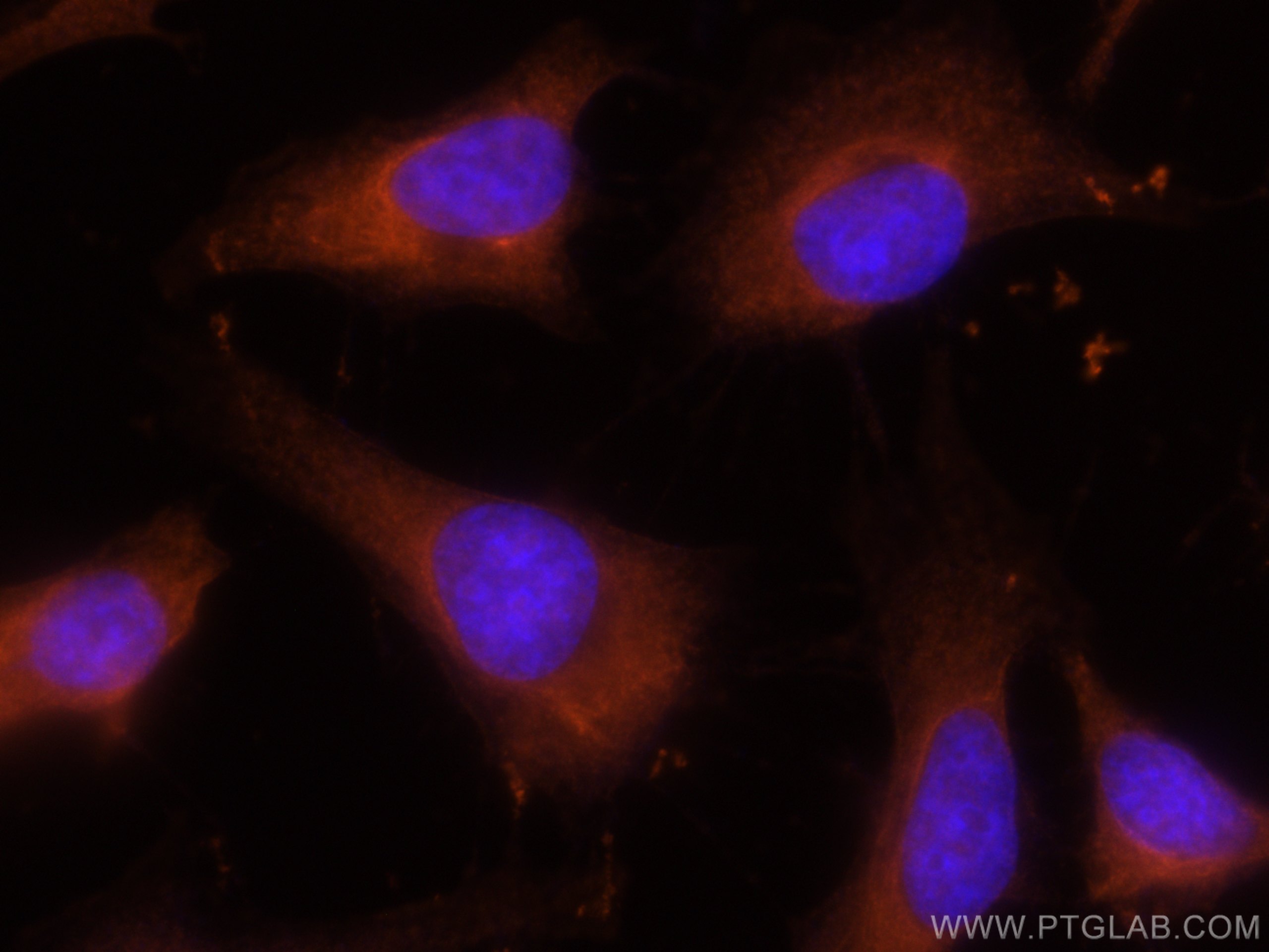 IF Staining of HeLa using CL555-12348