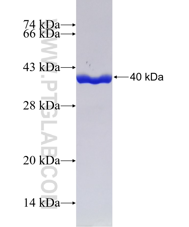 FABP5 fusion protein Ag3005 SDS-PAGE