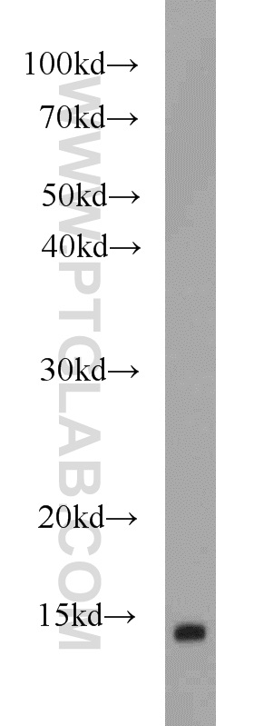 WB analysis of human brain using 17456-1-AP