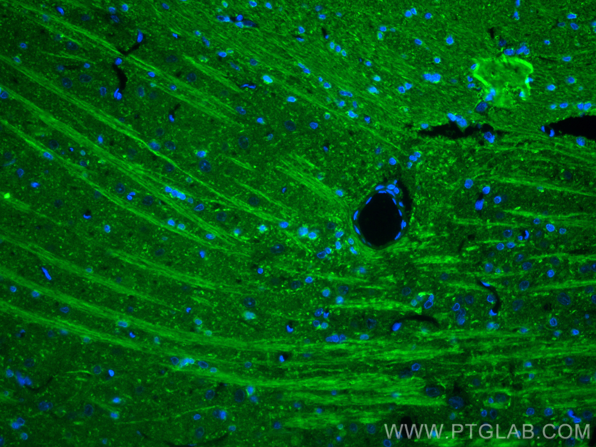 IF Staining of rat brain using 14836-1-AP