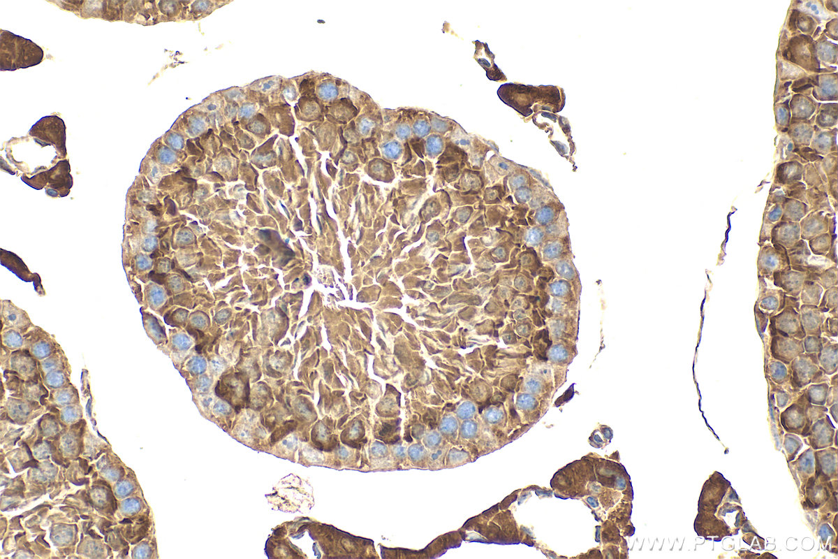 IHC staining of mouse testis using 31896-1-AP