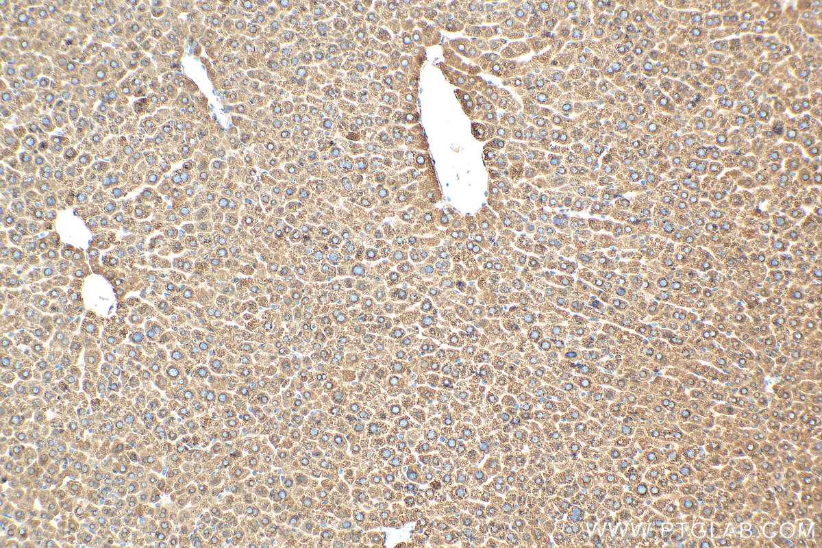 IHC staining of mouse liver using 68026-1-Ig (same clone as 68026-1-PBS)