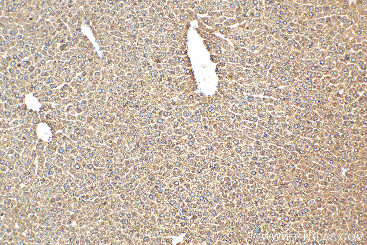 IHC staining of mouse liver using 68026-1-Ig