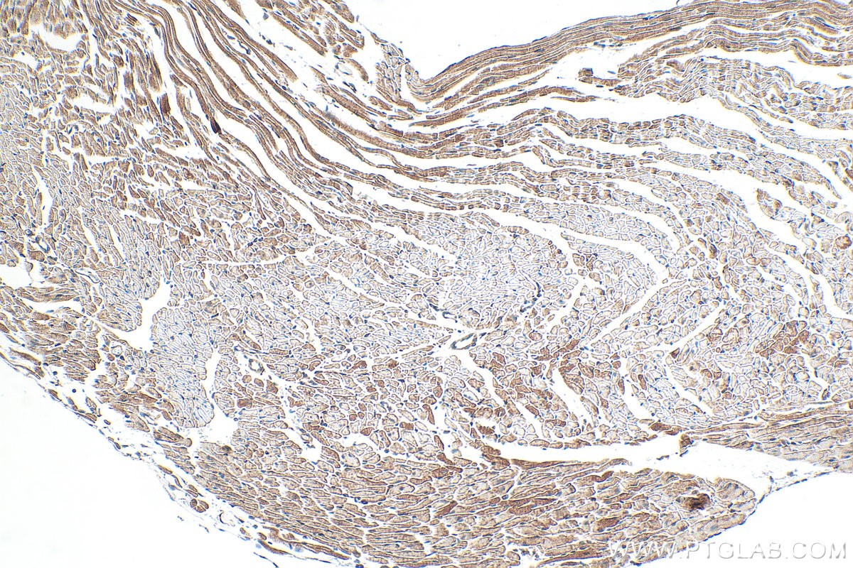 IHC staining of mouse heart using 84527-4-RR