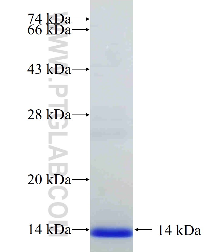 FADS2-Specific fusion protein Ag33119 SDS-PAGE FADS2-Specific fusion protein Ag33119 SDS-PAGE