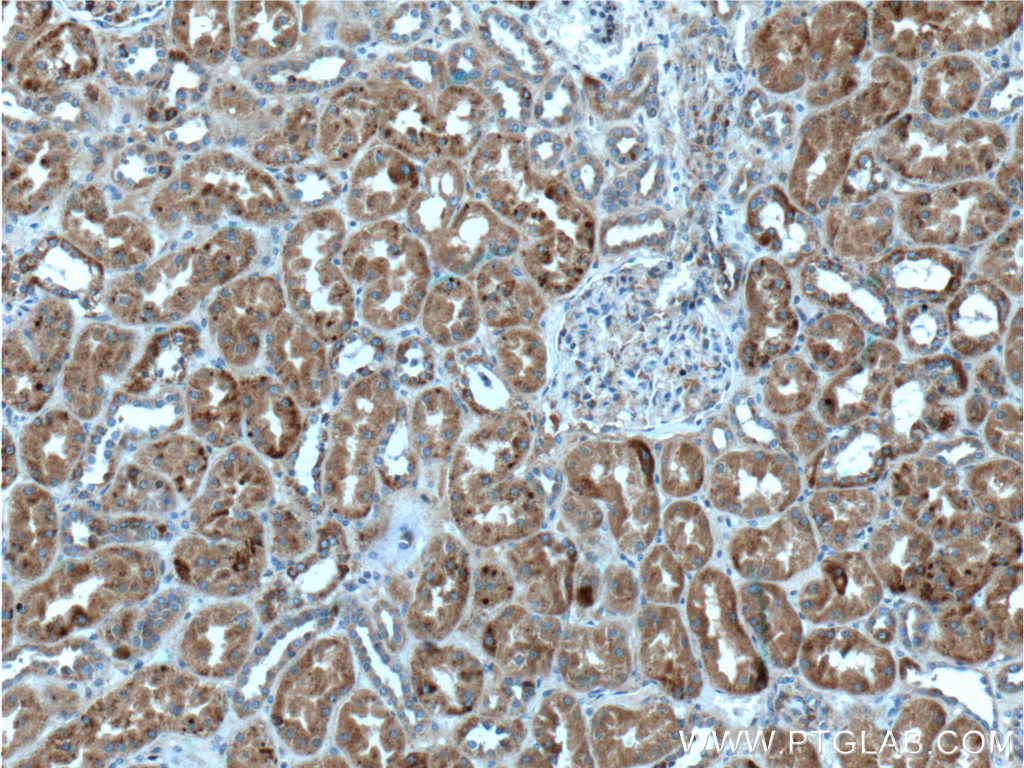 IHC staining of human kidney using 26233-1-AP