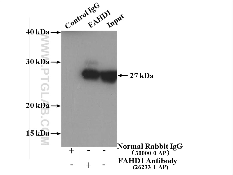 IP experiment of mouse kidney using 26233-1-AP