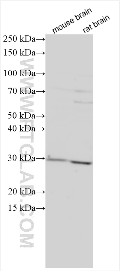 WB analysis using 15211-1-AP