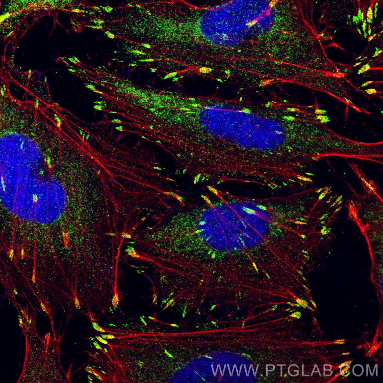 IF Staining of HUVEC using 12636-1-AP