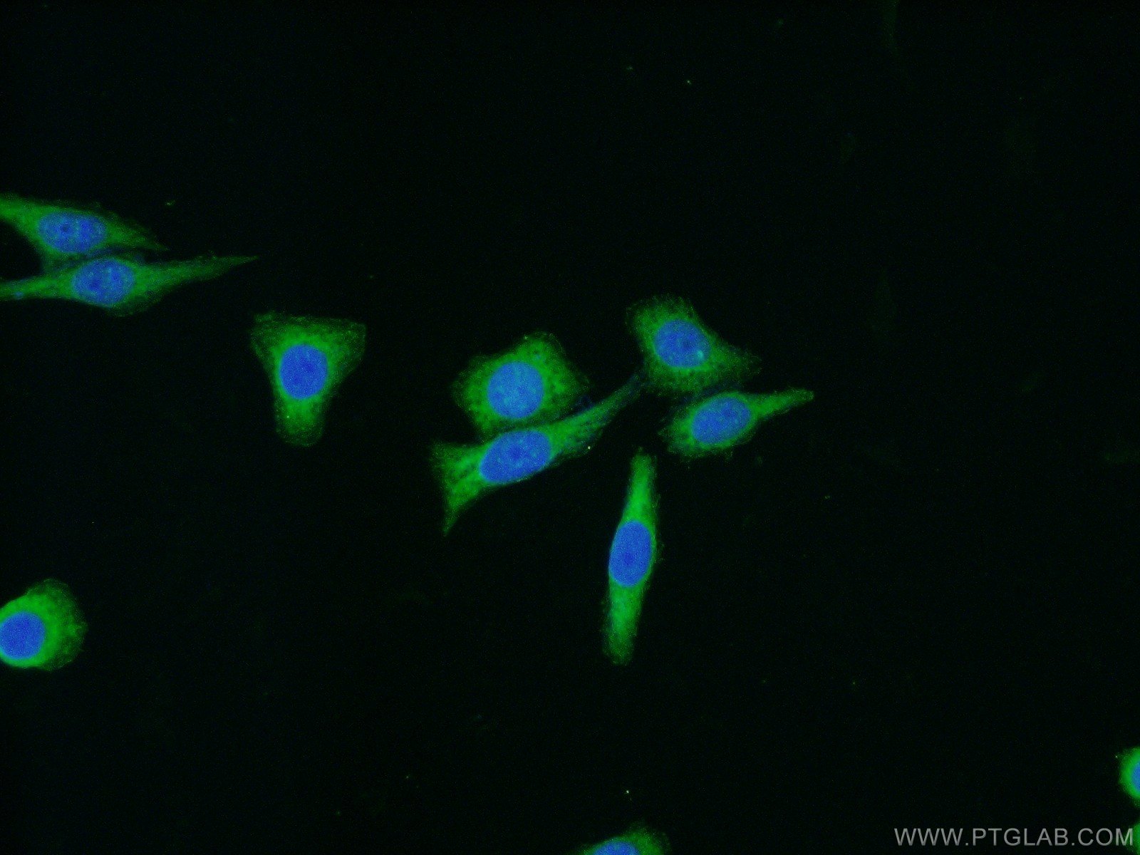 vinculin-antibody-26520-1-ap-proteintech