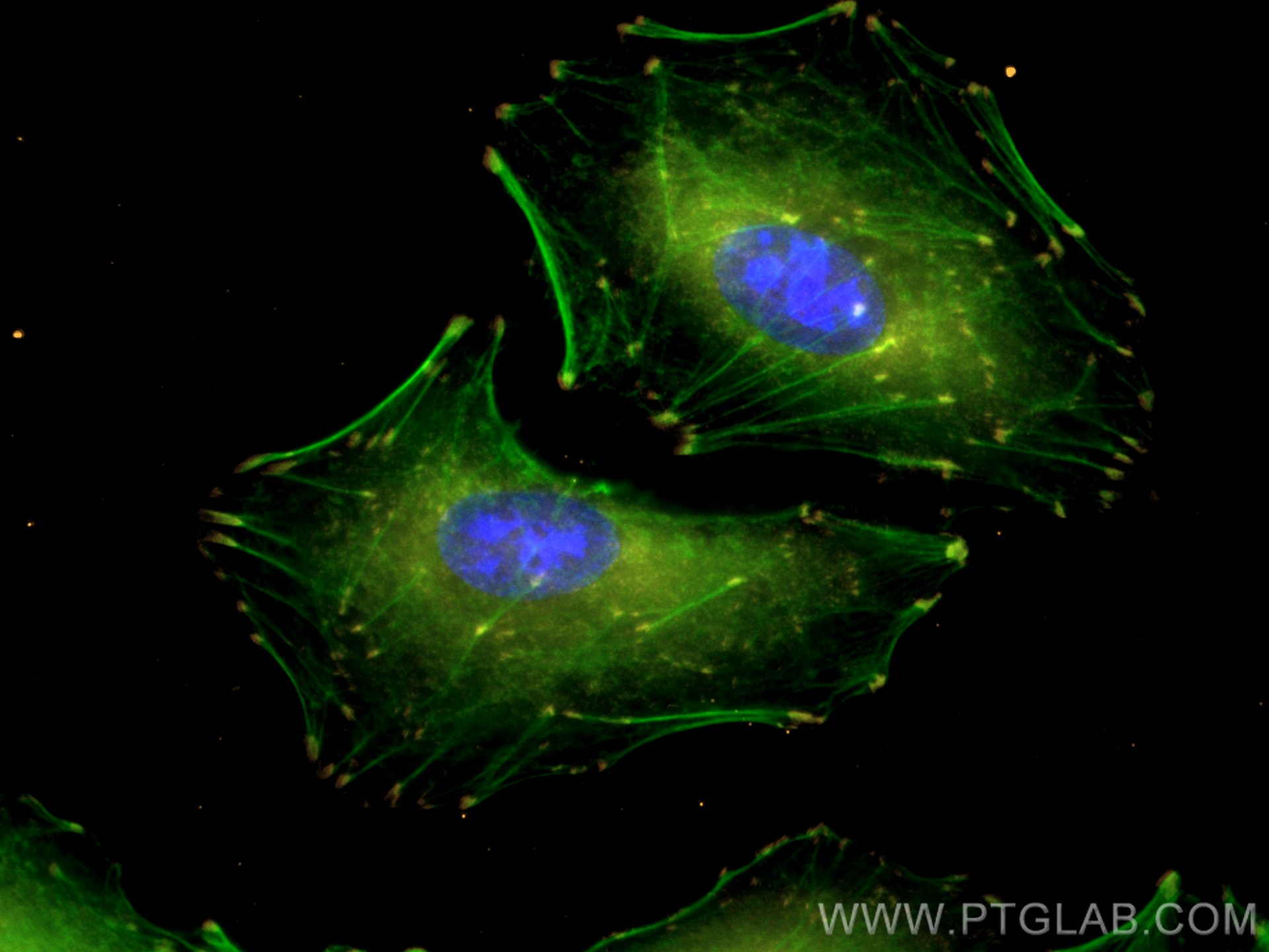 IF Staining of A549 using CL555-66258