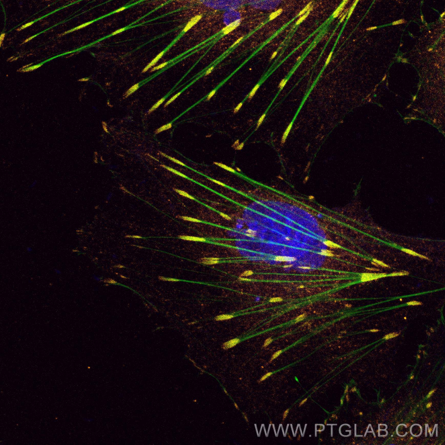 IF Staining of HUVEC using CL555-66258