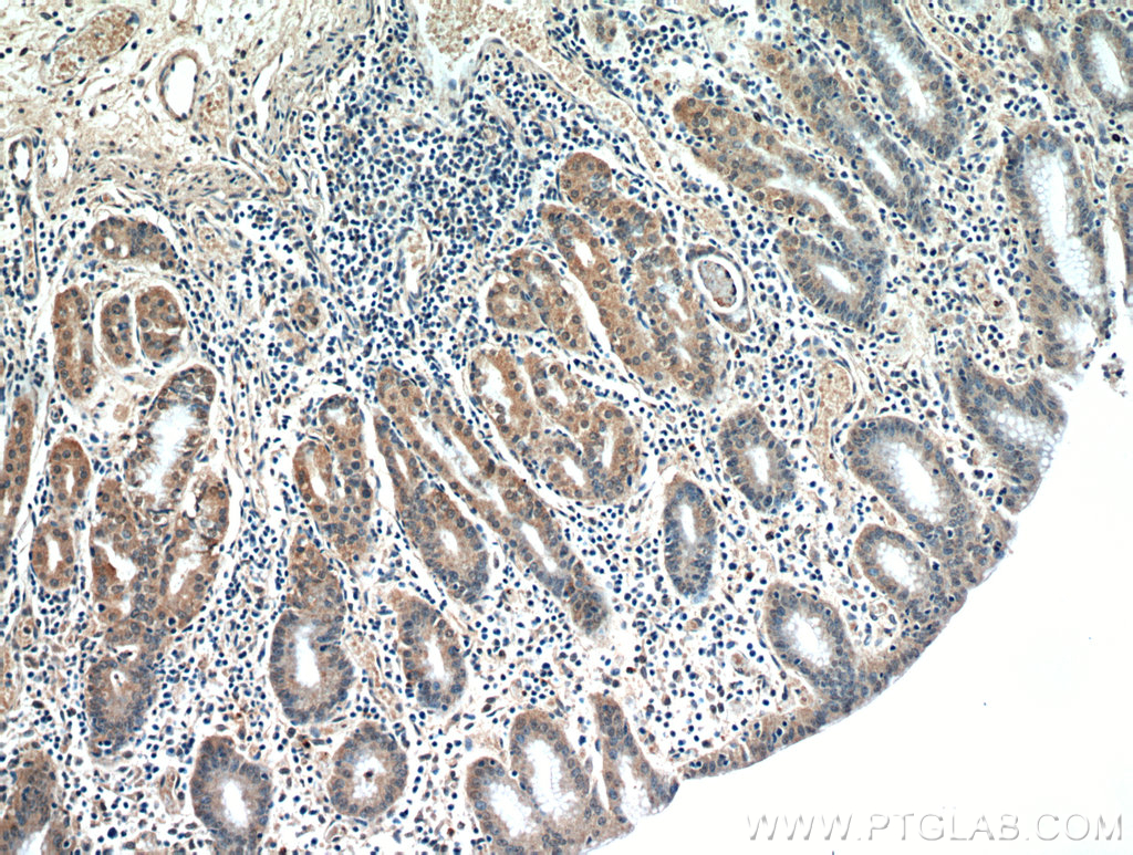 IHC staining of human stomach using 21113-1-AP (same clone as 21113-1-PBS)