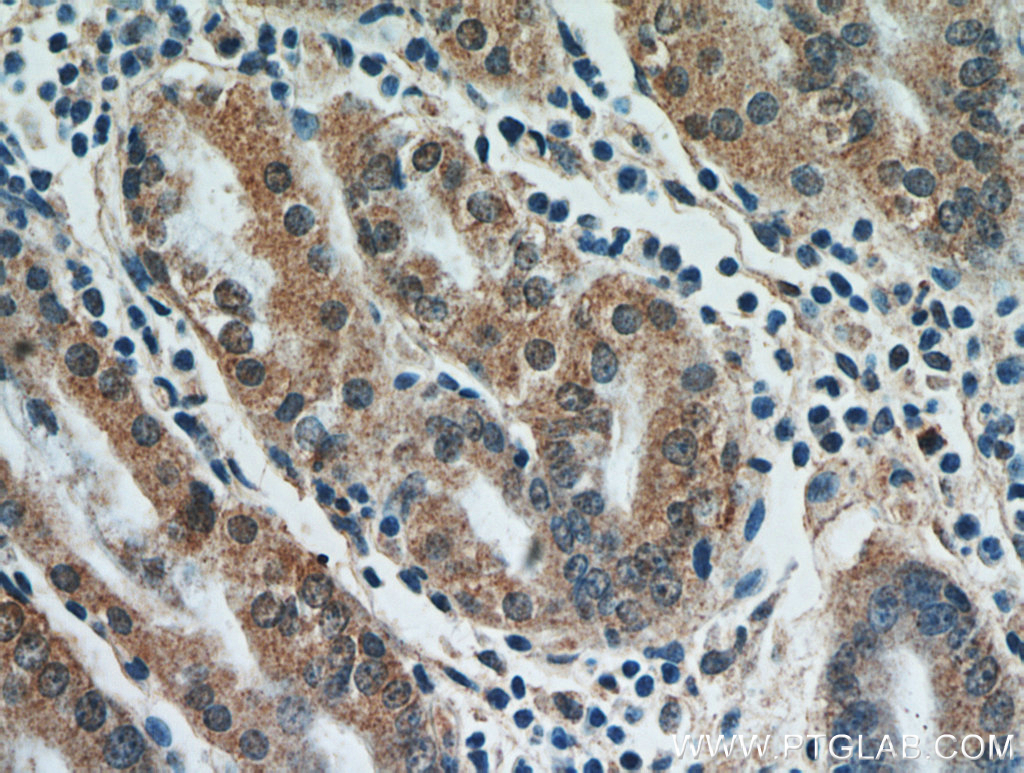 IHC staining of human stomach using 21113-1-AP (same clone as 21113-1-PBS)