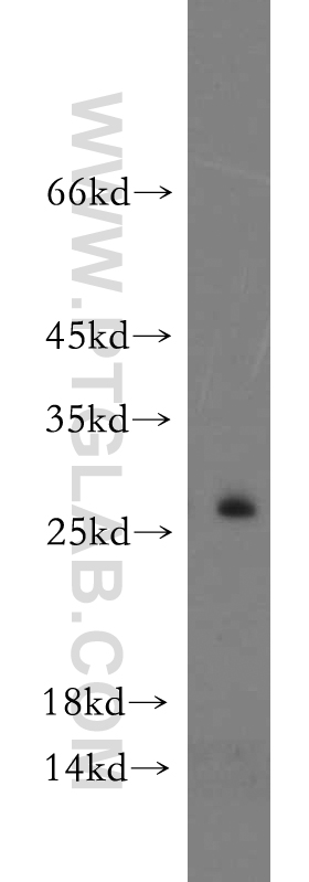 WB analysis of HepG2 using 21113-1-AP