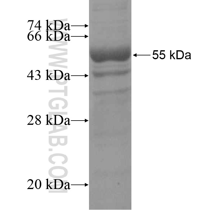 FAM101A fusion protein Ag15231 SDS-PAGE FAM101A fusion protein Ag15231 SDS-PAGE