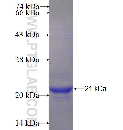 FAM101B fusion protein Ag23909 SDS-PAGE FAM101B fusion protein Ag23909 SDS-PAGE