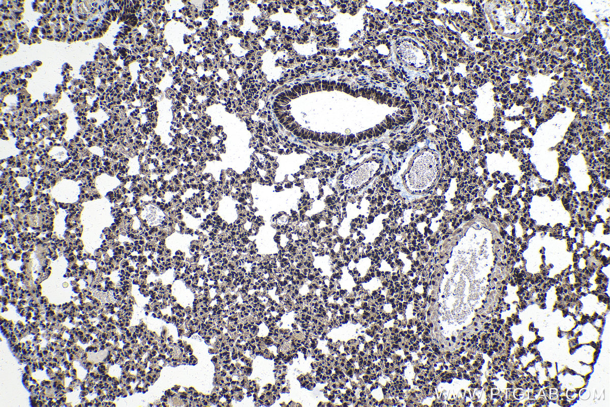 IHC staining of mouse lung using 19422-1-AP