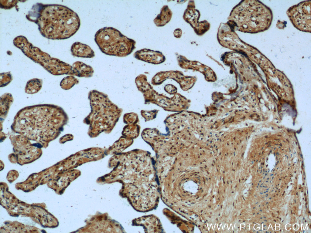 IHC staining of human placenta using 25668-1-AP