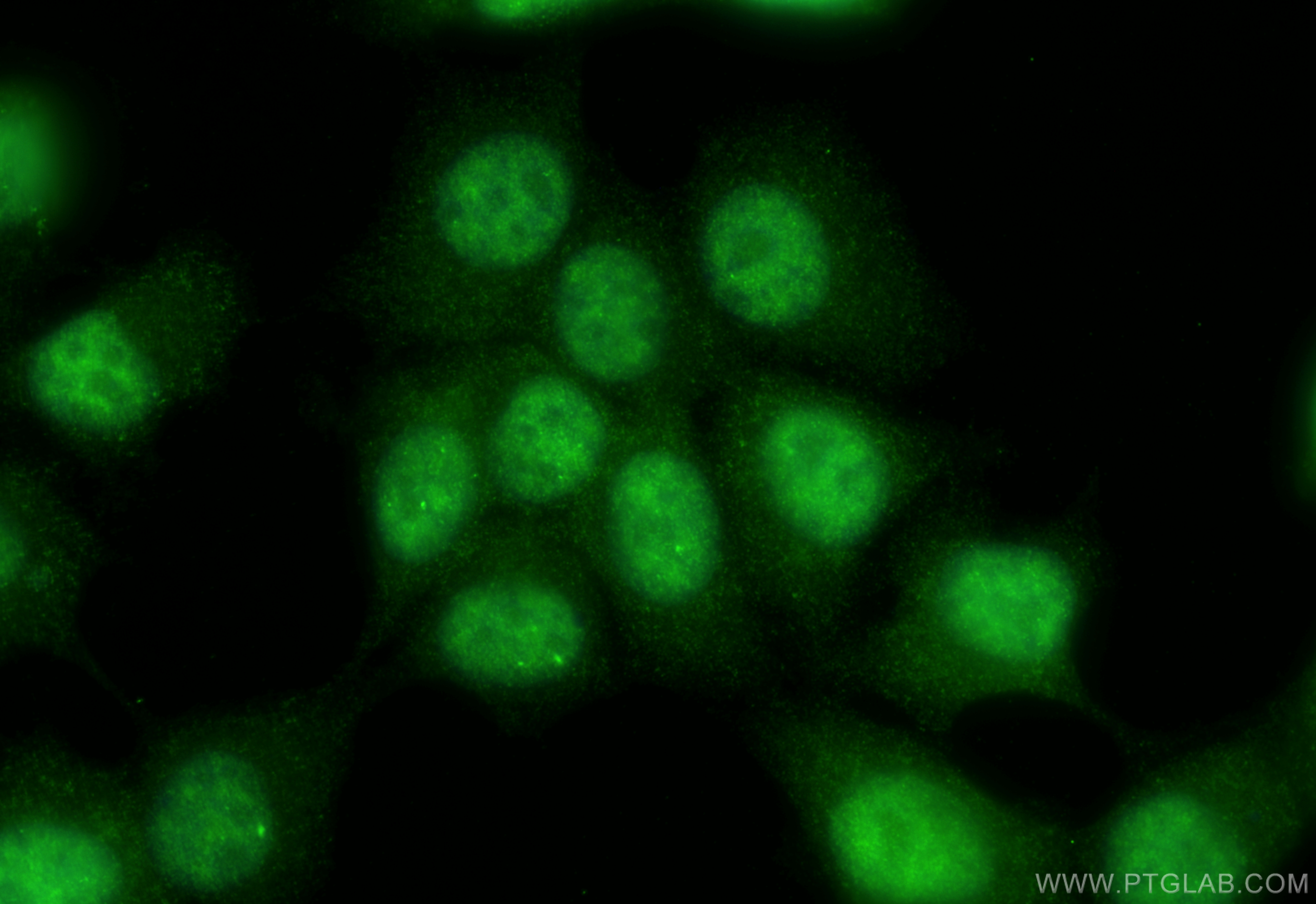 IF Staining of MCF-7 using 12176-1-AP