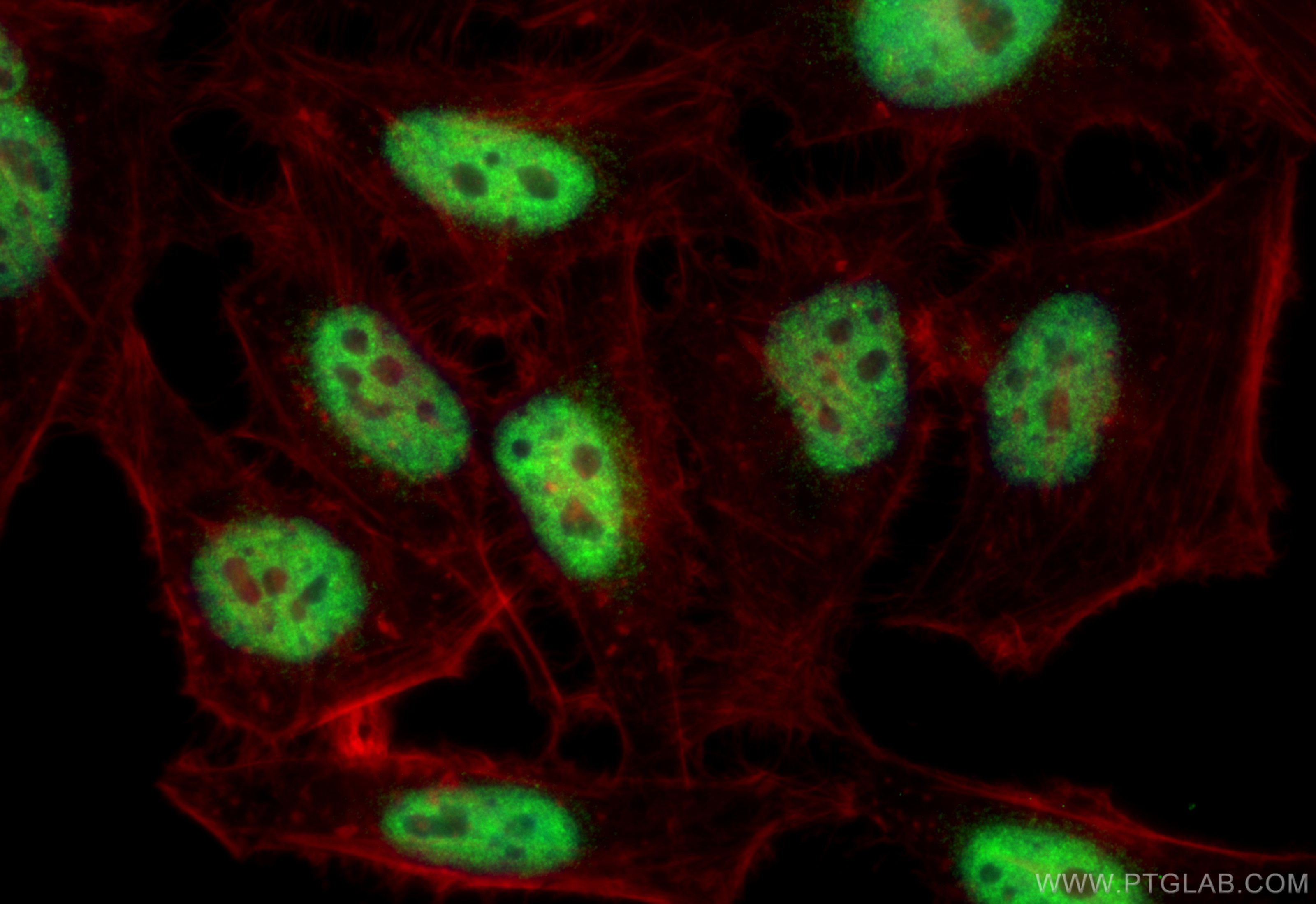 IF Staining of HeLa using 12176-1-AP (same clone as 12176-1-PBS)