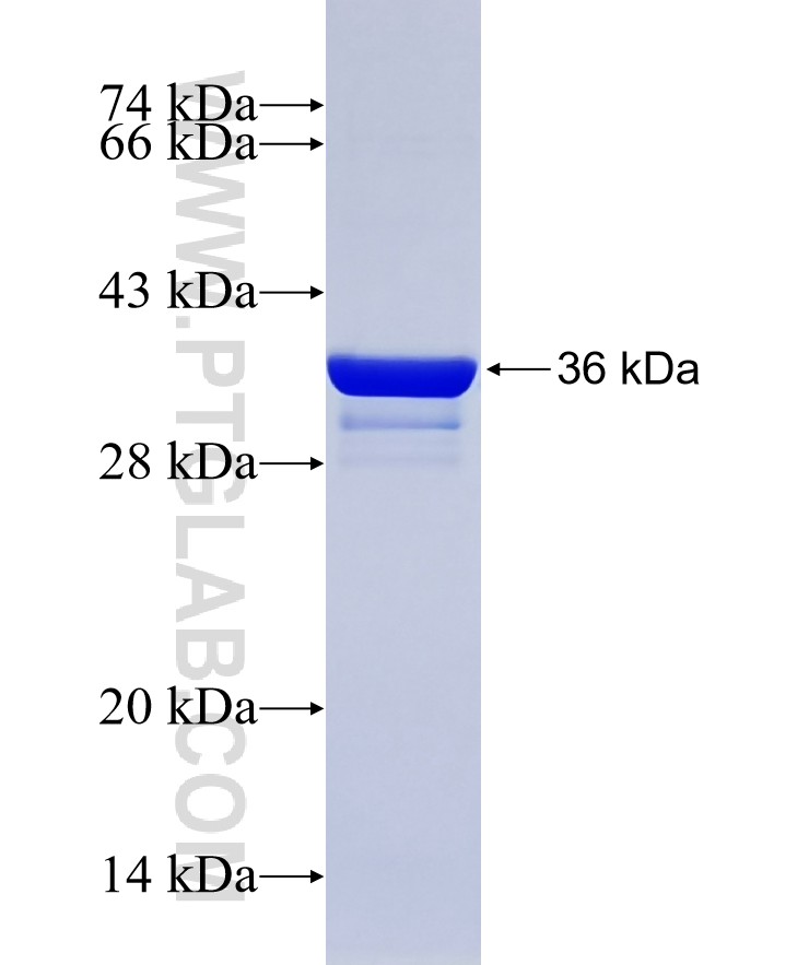 FAM107B fusion protein Ag14389 SDS-PAGE