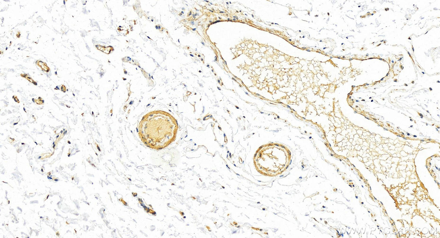 IHC staining of human colon using 15854-1-AP