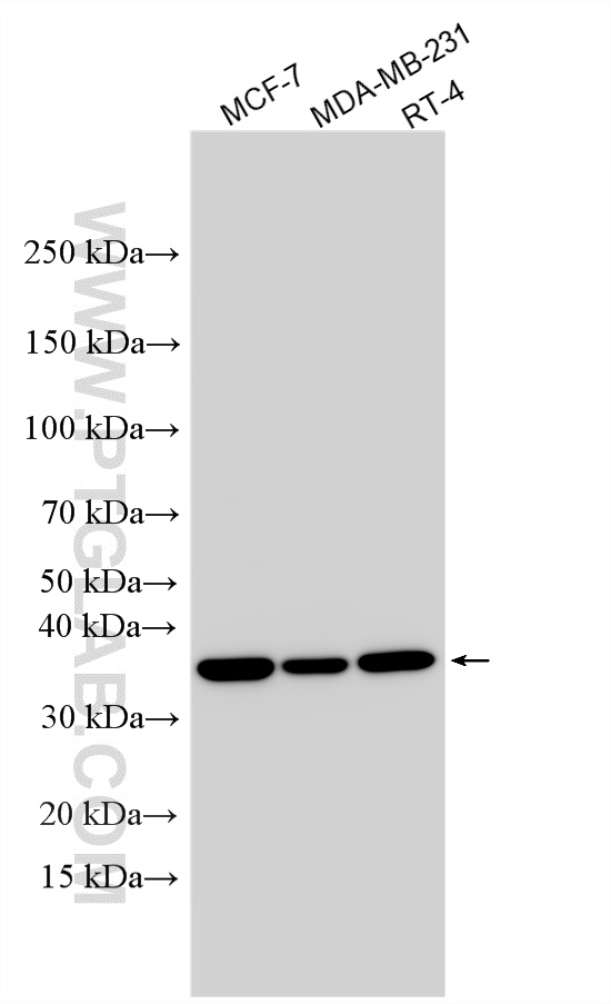 WB analysis using 33561-1-AP (same clone as 33561-1-PBS) WB analysis using 33561-1-AP (same clone as 33561-1-PBS)