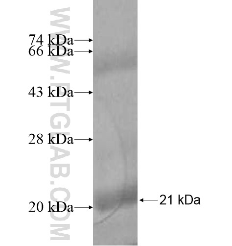 FAM110A fusion protein Ag14458 SDS-PAGE FAM110A fusion protein Ag14458 SDS-PAGE