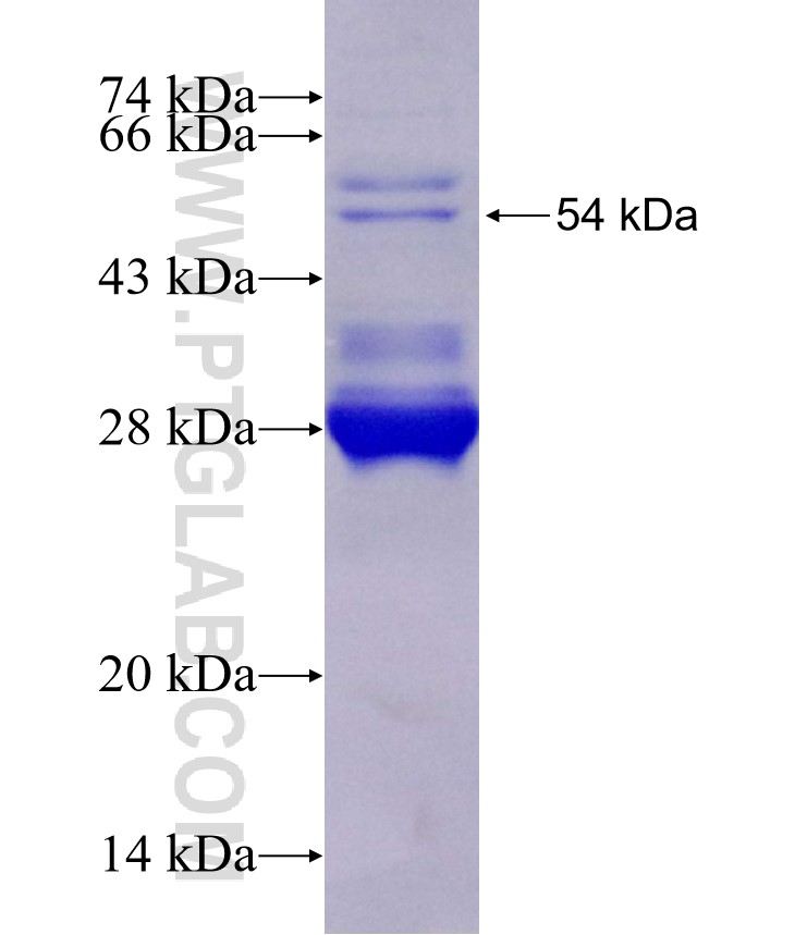 FAM111B fusion protein Ag29376 SDS-PAGE