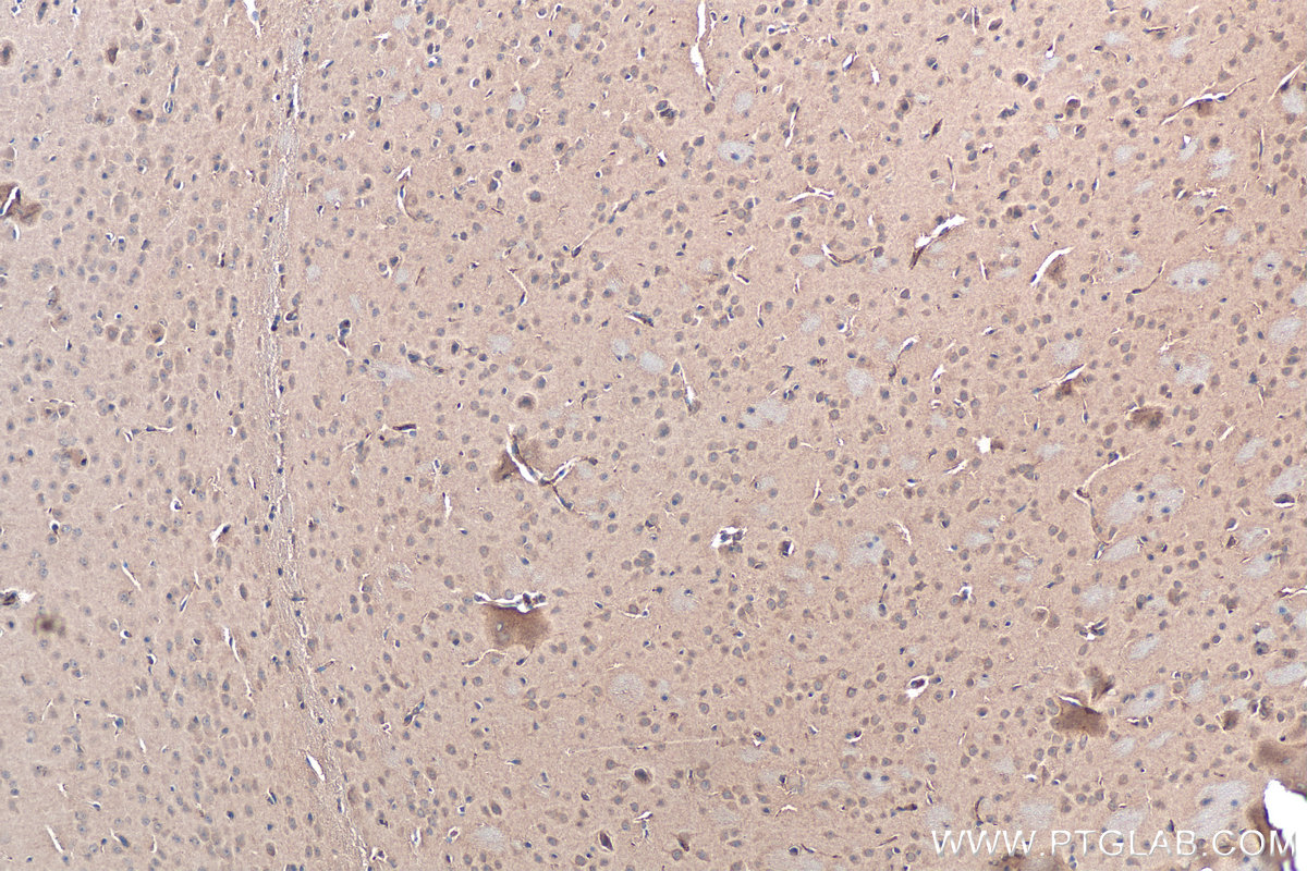 IHC staining of mouse brain using 21638-1-AP