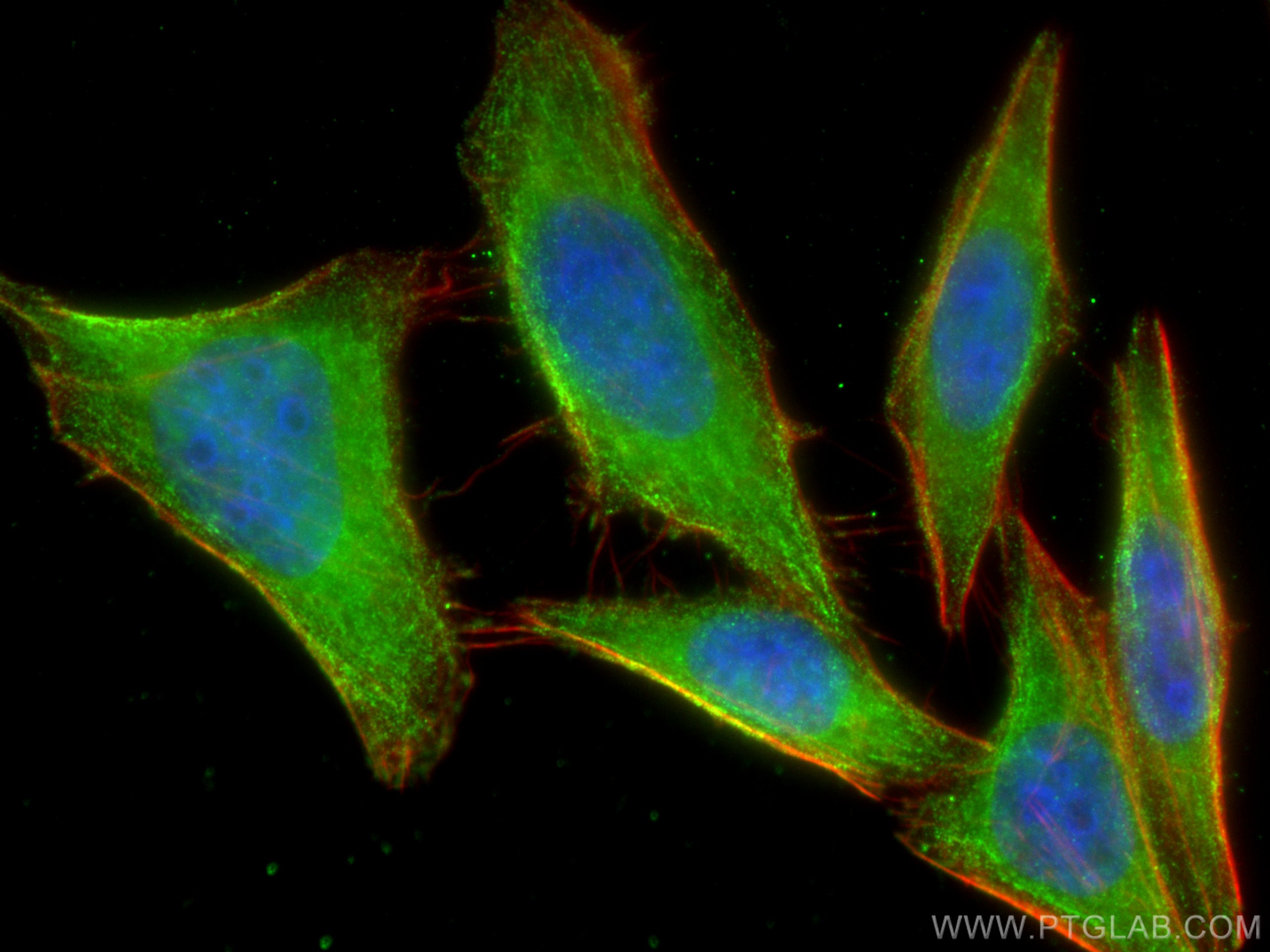 IF Staining of HepG2 using 67926-1-Ig (same clone as 67926-1-PBS)