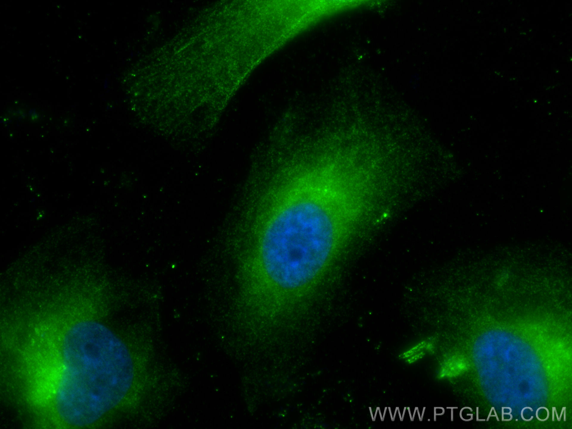 IF Staining of HeLa using 29917-1-AP
