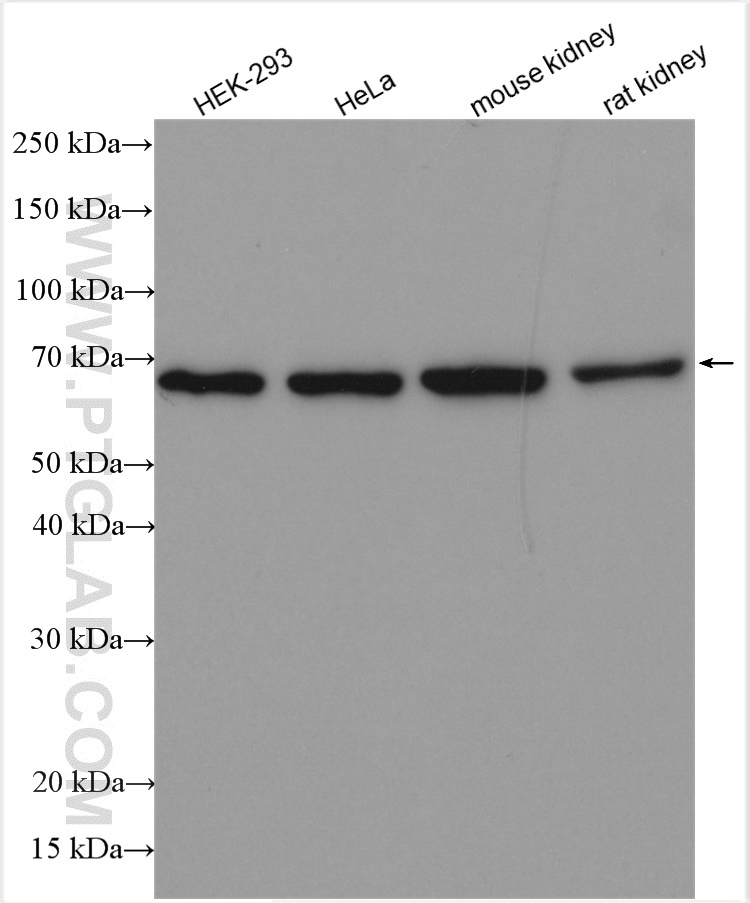 WB analysis using 21768-1-AP