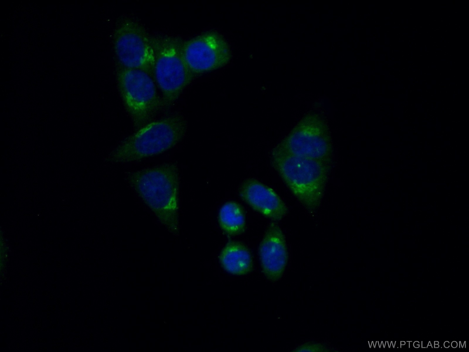 IF Staining of HepG2 using 25987-1-AP
