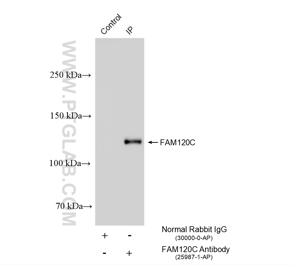 IP experiment of HepG2 using 25987-1-AP