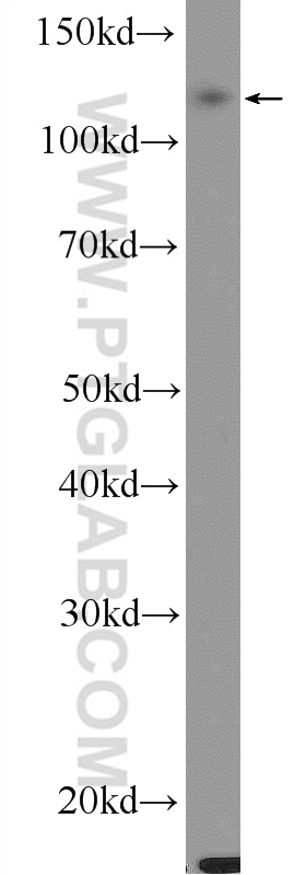 WB analysis of HepG2 using 25987-1-AP