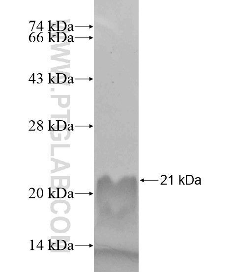 FAM122A fusion protein Ag19118 SDS-PAGE FAM122A fusion protein Ag19118 SDS-PAGE