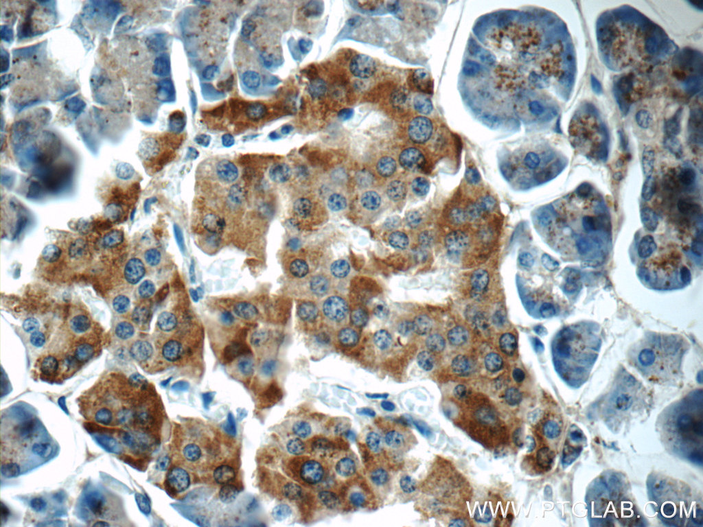 IHC staining of human pancreas using 25816-1-AP