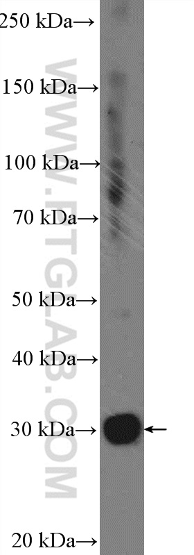 WB analysis of Jurkat using 25816-1-AP