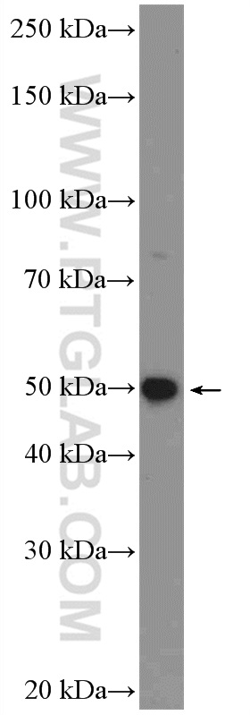 WB analysis of K-562 using 26243-1-AP