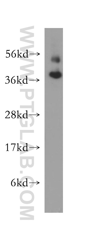 human brain tissue were subjected to SDS PAGE followed by western blot with 10307-1-AP (FAM127A antibody) at dilution of 1:300 incubated at room temperature for 1.5 hours. WB analysis of human brain using 10307-1-AP