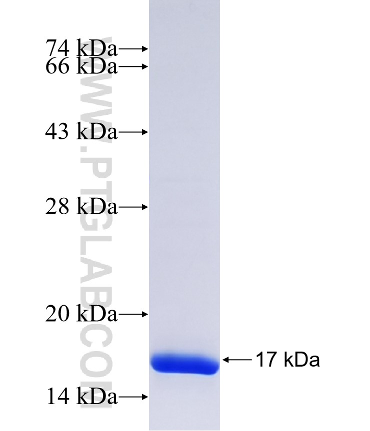 FAM127B fusion protein Ag37520 SDS-PAGE FAM127B fusion protein Ag37520 SDS-PAGE