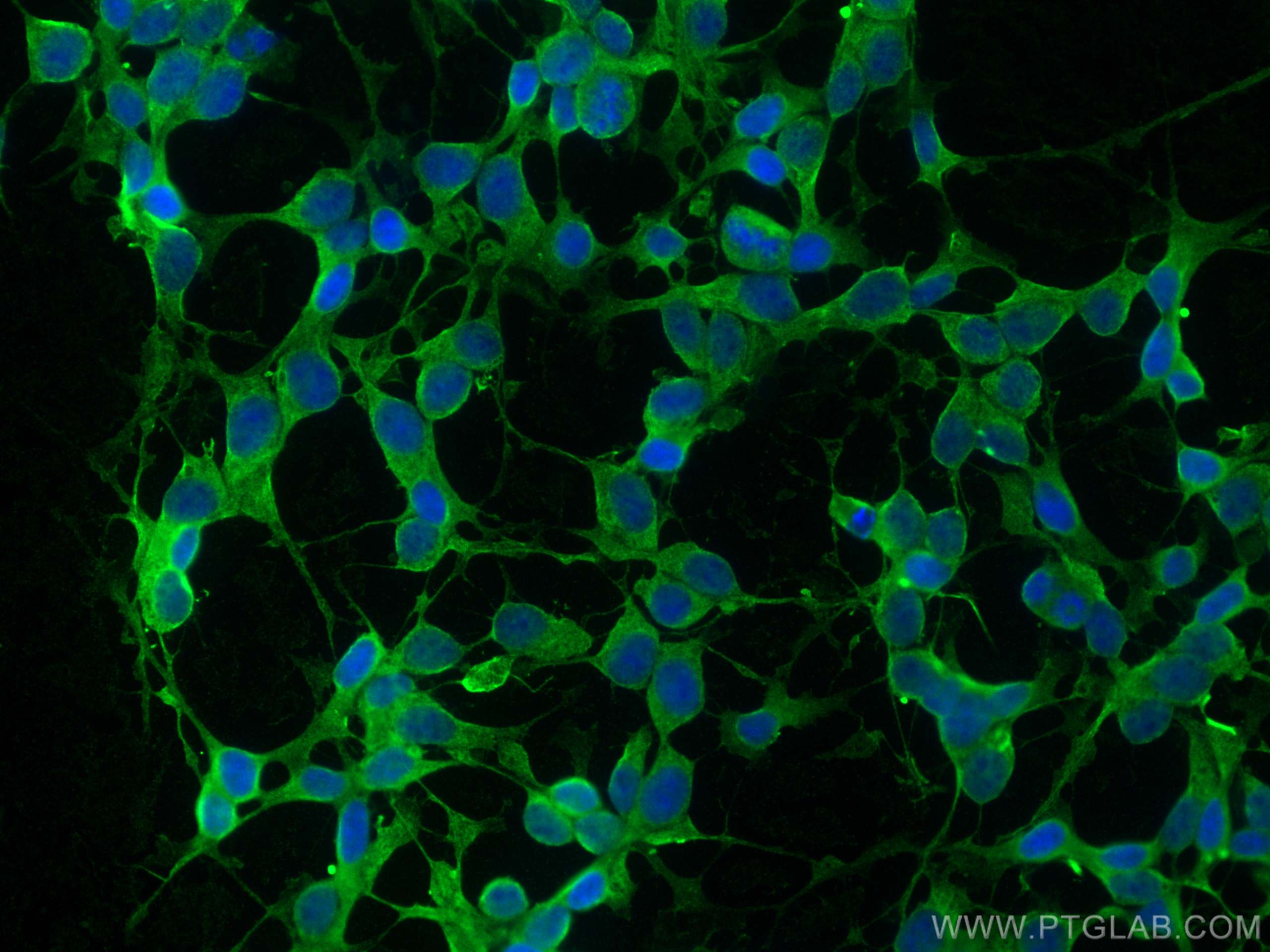 IF Staining of SH-SY5Y using 26498-1-AP